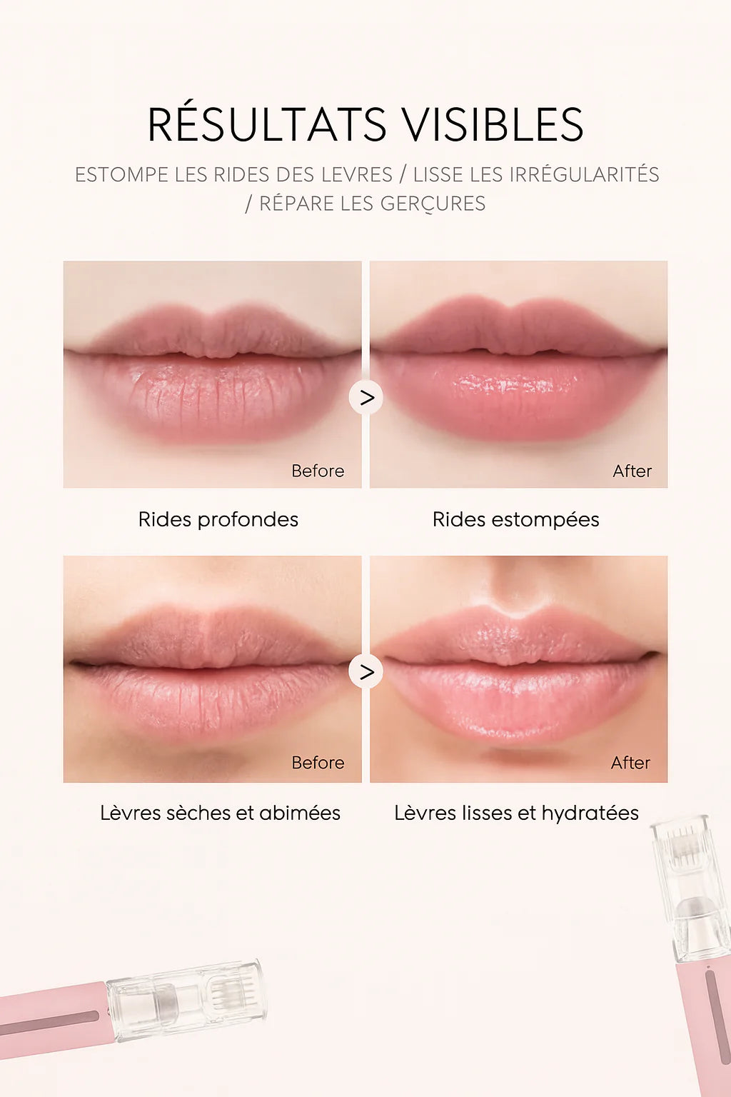 Derma Roller Titanium – Stimulation et Applicateur de Sérum