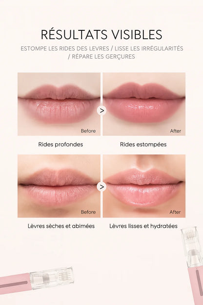 Derma Roller Titanium – Stimulation et Applicateur de Sérum