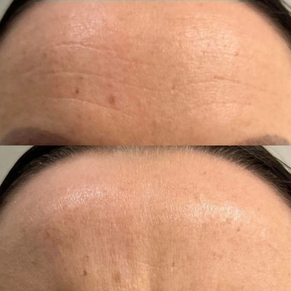 Hoygi – Crème Gelée au Collagène